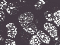これはダメージを受けた角膜上皮細胞の写真です。